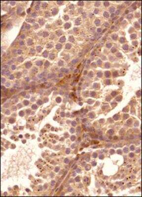Immunohistochemistry-Paraffin: FAM8A1 Antibody - BSA Free [NBP2-47125]