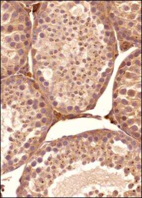 Immunohistochemistry-Paraffin: FAM8A1 Antibody - BSA Free [NBP2-47125]