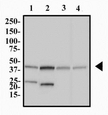 Western Blot: FAM8A1 AntibodyBSA Free [NBP2-47125]