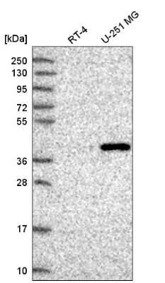 Western Blot: FAM8A1 Antibody [NBP2-58571]