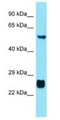 Western Blot: FAM90A10P Antibody [NBP3-09715]