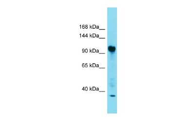 Western Blot: FAM91A1 Antibody [NBP2-87431]