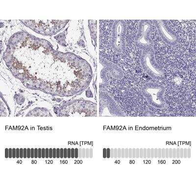 Immunohistochemistry-Paraffin: FAM92A1 Antibody [NBP2-76554]