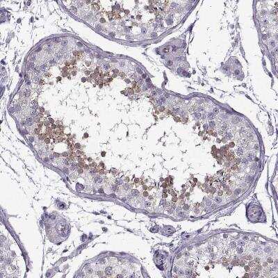 Immunohistochemistry-Paraffin: FAM92A1 Antibody [NBP2-76554]