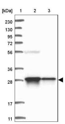 Western Blot: FAM92A1 Antibody [NBP1-93794]