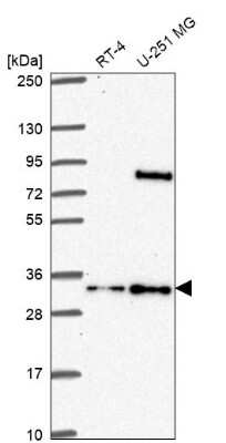 Western Blot: FAM92A1 Antibody [NBP2-76554]