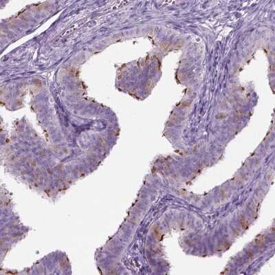 Immunohistochemistry-Paraffin: FAM92B Antibody [NBP1-81895]