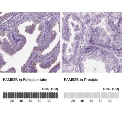 Immunohistochemistry-Paraffin: FAM92B Antibody [NBP1-81895]