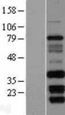 Western Blot: FAM92B Overexpression Lysate [NBL1-10582]