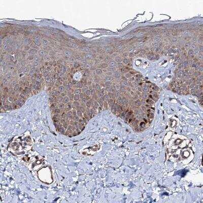 Immunohistochemistry-Paraffin: FAM96A Antibody [NBP1-82100]
