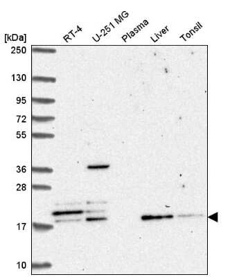 Western Blot: FAM96A Antibody [NBP2-57106]