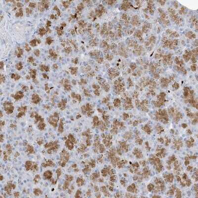 Immunohistochemistry-Paraffin: FAM98A Antibody [NBP1-85086]