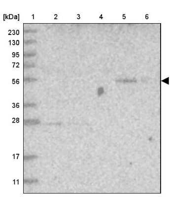 Western Blot: FAM98A Antibody [NBP1-85086]