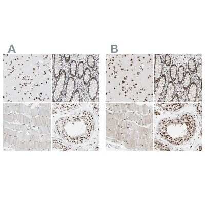Immunohistochemistry-Paraffin: FAM98B Antibody [NBP1-83474]