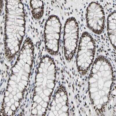 Immunohistochemistry-Paraffin: FAM98B Antibody [NBP1-83474]