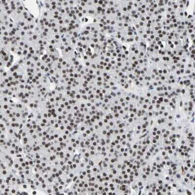 Immunohistochemistry-Paraffin: FAM98B Antibody [NBP1-83474]