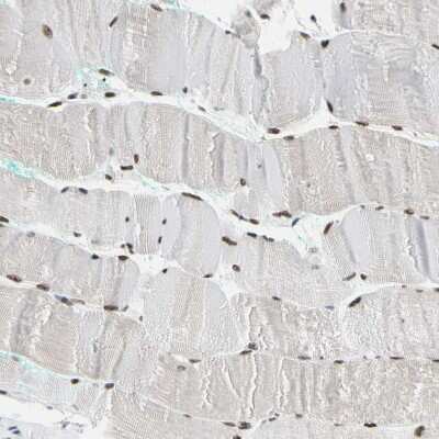 Immunohistochemistry-Paraffin: FAM98B Antibody [NBP1-83474]