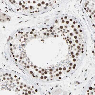 Immunohistochemistry-Paraffin: FAM98B Antibody [NBP1-83474]