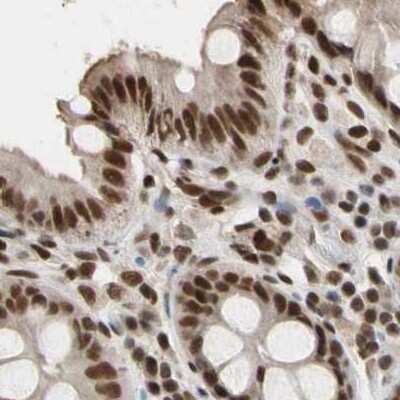 Immunohistochemistry-Paraffin: FAM98B Antibody [NBP1-83475]