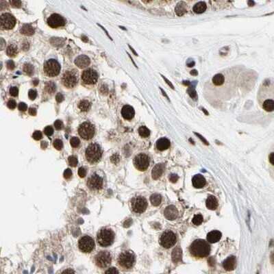 Immunohistochemistry-Paraffin: FAM98B Antibody [NBP1-83475]