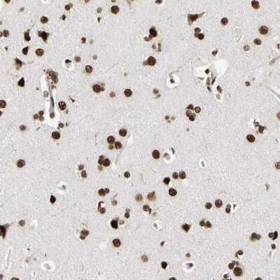 Immunohistochemistry-Paraffin: FAM98B Antibody [NBP1-83475]