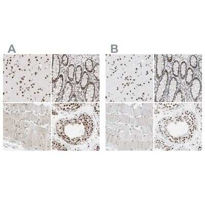 Immunohistochemistry-Paraffin: FAM98B Antibody [NBP1-83475]