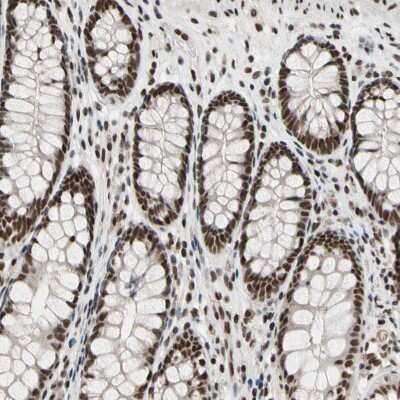 Immunohistochemistry-Paraffin: FAM98B Antibody [NBP1-83475]