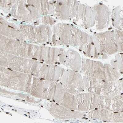Immunohistochemistry-Paraffin: FAM98B Antibody [NBP1-83475]