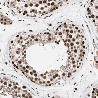 Immunohistochemistry-Paraffin: FAM98B Antibody [NBP1-83475]