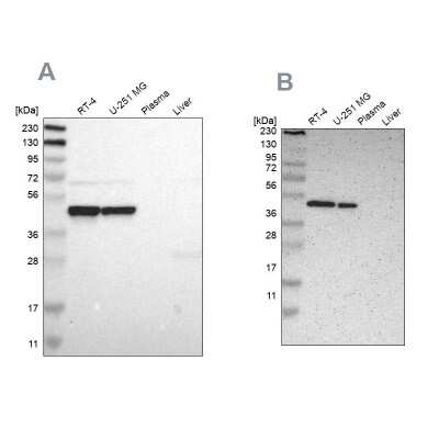 Western Blot: FAM98B Antibody [NBP1-83474]