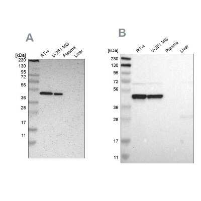 Western Blot: FAM98B Antibody [NBP1-83475]