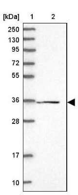 Western Blot: FAM98C Antibody [NBP1-93753]