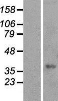 Western Blot: FAM98C Overexpression Lysate [NBP2-05095]