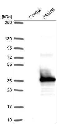 Western Blot: FAM9B Antibody [NBP1-89431]