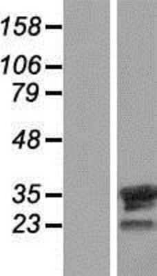 Western Blot: FAM9B Overexpression Lysate [NBP2-04530]