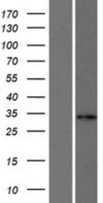 Western Blot: FACA/FANCA Overexpression Lysate [NBP2-08666]