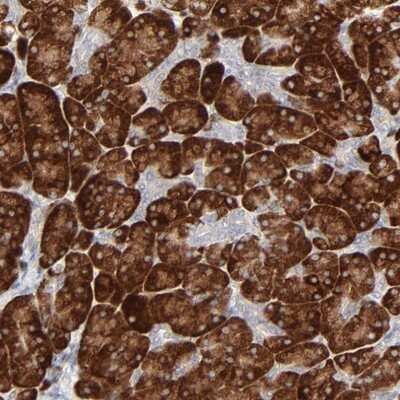 Immunohistochemistry-Paraffin: FANCB Antibody [NBP1-84757]