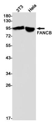 Western Blot: FANCB Antibody (S05-8B7) [NBP3-19631]