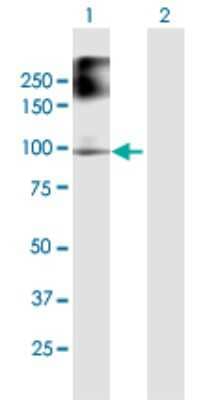 Western Blot: FANCB Antibody [H00002187-B01P]