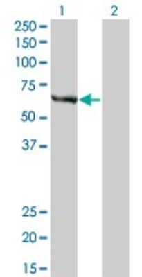 Western Blot: FANCC Antibody (6E7) [H00002176-M01]