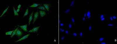 Immunocytochemistry/ Immunofluorescence: FANCC Antibody [NBP3-12777]