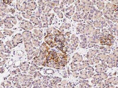 Immunohistochemistry-Paraffin: FANCC Antibody [NBP3-12777]