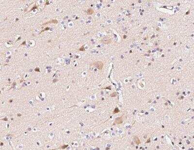 Immunohistochemistry-Paraffin: FANCC Antibody [NBP3-12777]