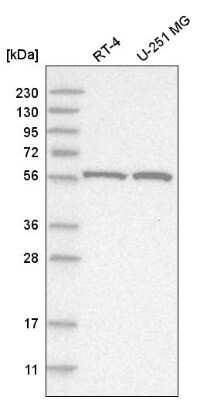 Western Blot: FANCC Antibody [NBP2-55256]