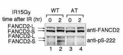 Western Blot: FANCD2 [p Ser222] Antibody [NB100-502]