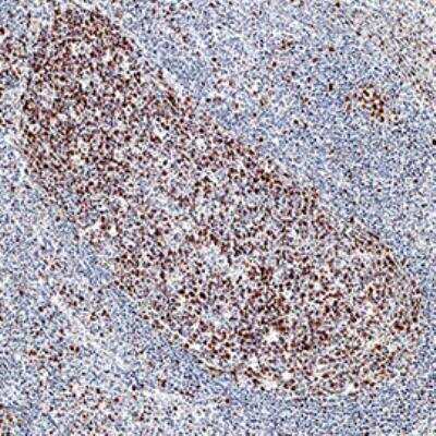 Immunohistochemistry: FANCD2 Antibody (1290D) - BSA Free [NBP2-54808]