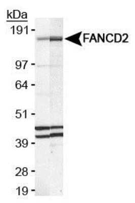 Western Blot: FANCD2 Antibody (FI-17) [NB100-316]