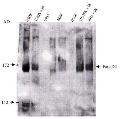 Western Blot: FANCD2 Antibody (FI-17) [NB100-316]