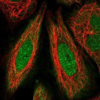 Immunocytochemistry/ Immunofluorescence: FANCD2 Antibody [NBP2-57171]