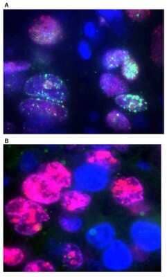 Immunohistochemistry: FANCD2 Antibody - BSA Free [NB100-182]